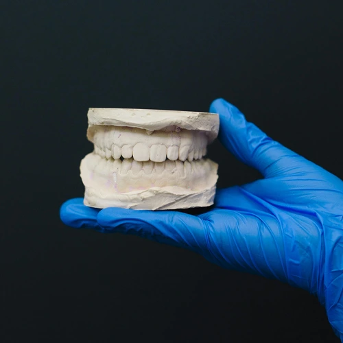 CRAZir-3D-Pro-dental-lab-feedback