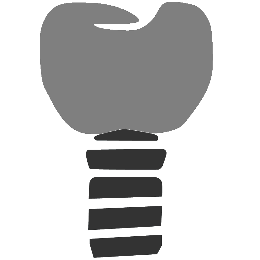 Implant-Full-Contour