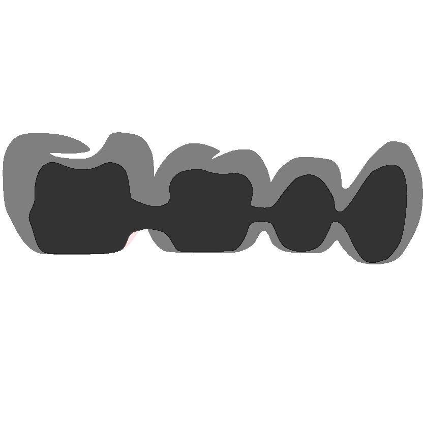 Inner-Crown-Bridge≥4-Unit